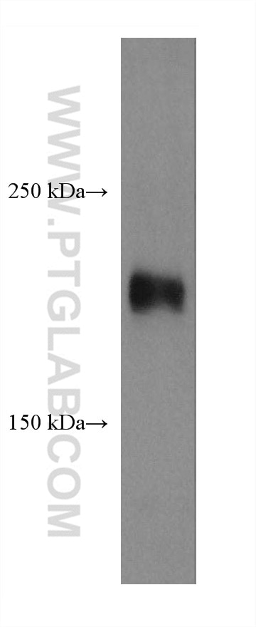 Western Blot (WB) analysis of Y79 cells using ROBO1 Monoclonal antibody (67922-1-Ig)