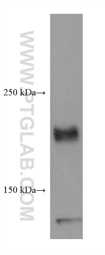 Western Blot (WB) analysis of U-87 MG cells using ROBO1 Monoclonal antibody (67922-1-Ig)