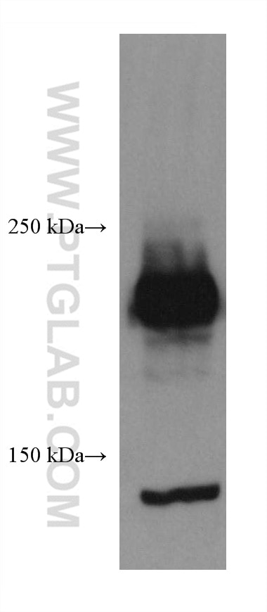 Western Blot (WB) analysis of HeLa cells using ROBO1 Monoclonal antibody (67922-1-Ig)