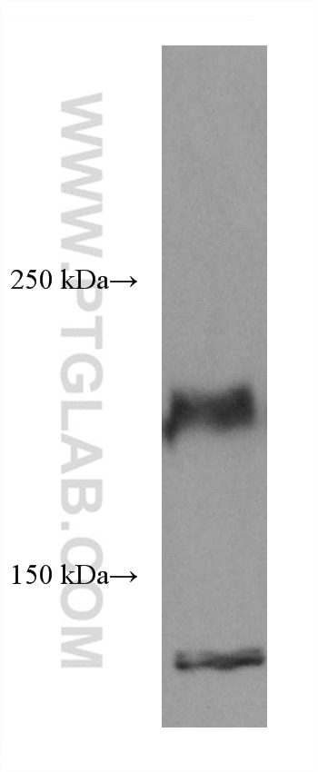 Western Blot (WB) analysis of HEK-293 cells using ROBO1 Monoclonal antibody (67922-1-Ig)