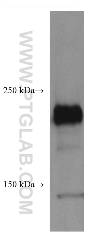 Western Blot (WB) analysis of HepG2 cells using ROBO1 Monoclonal antibody (67922-1-Ig)