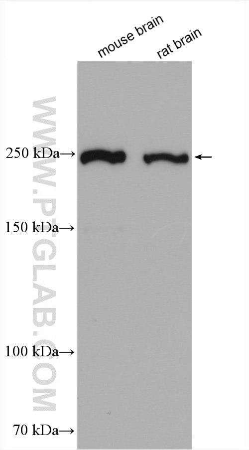 Western Blot (WB) analysis of various lysates using ROBO1-Specific Polyclonal antibody (20219-1-AP)