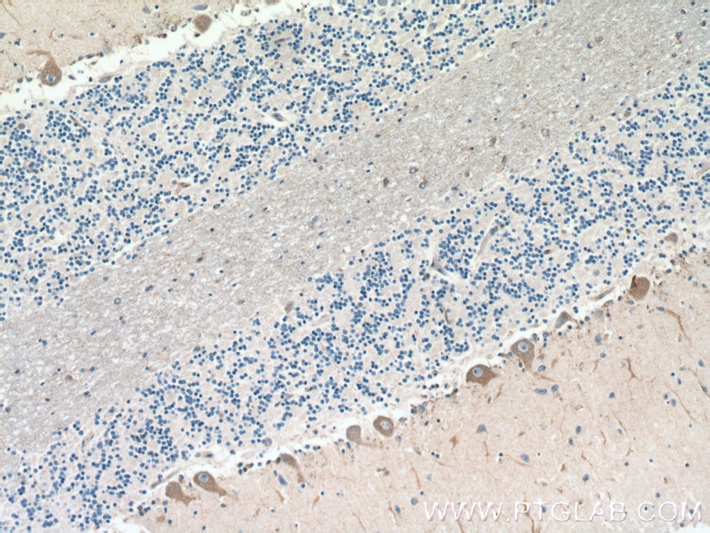 Immunohistochemistry (IHC) staining of human cerebellum tissue using ROBO2 Polyclonal antibody (19986-1-AP)