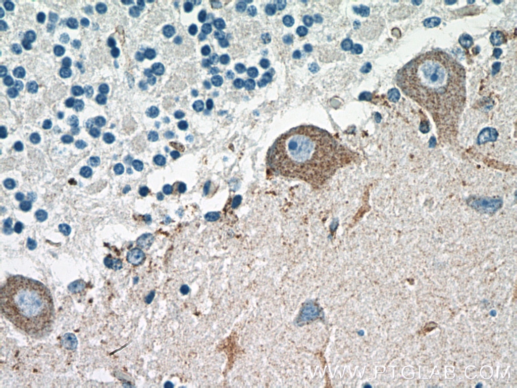 Immunohistochemistry (IHC) staining of human cerebellum tissue using ROBO2 Polyclonal antibody (19986-1-AP)