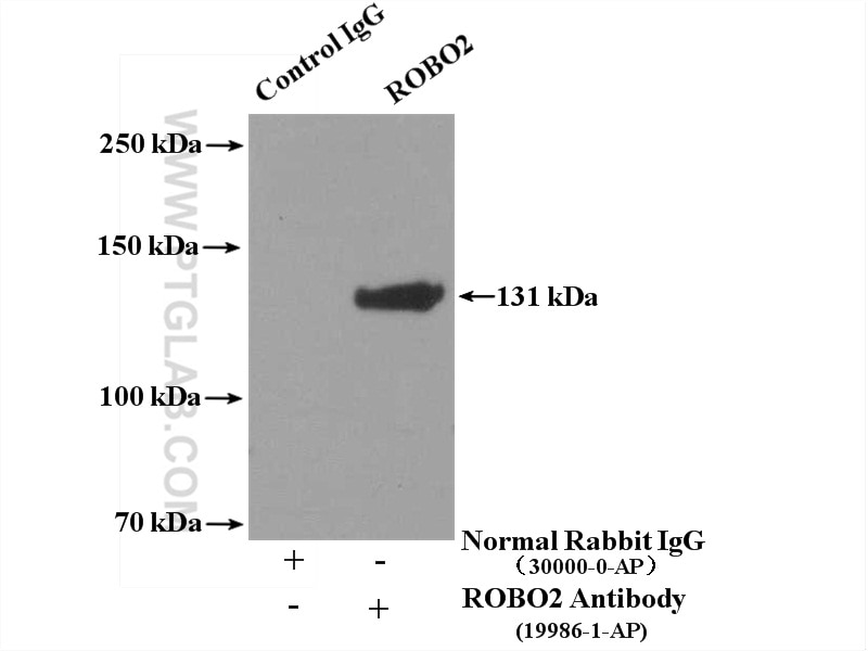 Immunoprecipitation (IP) experiment of SH-SY5Y cells using ROBO2 Polyclonal antibody (19986-1-AP)