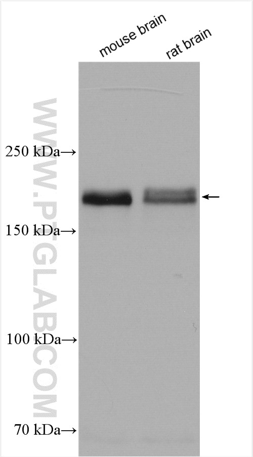 Western Blot (WB) analysis of various lysates using ROBO2 Polyclonal antibody (21635-1-AP)