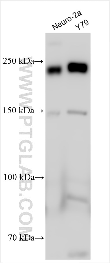 Western Blot (WB) analysis of various lysates using ROBO3 Polyclonal antibody (11982-1-AP)