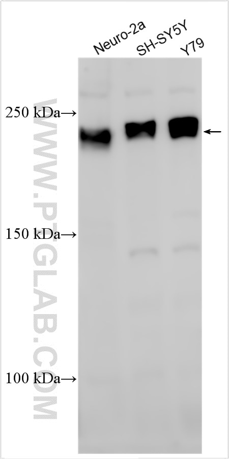 Western Blot (WB) analysis of various lysates using ROBO3 Polyclonal antibody (11982-1-AP)