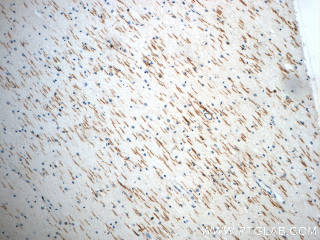 Immunohistochemistry (IHC) staining of human brain tissue using ROBO3-Specific Polyclonal antibody (20220-1-AP)