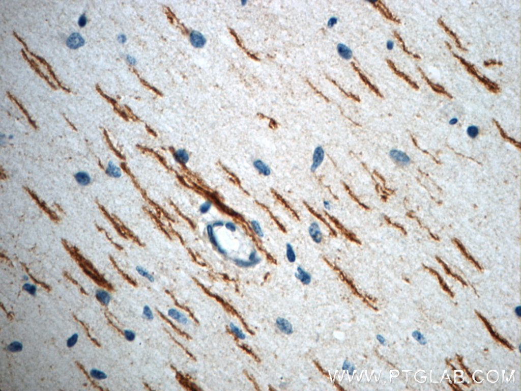 Immunohistochemistry (IHC) staining of human brain tissue using ROBO3-Specific Polyclonal antibody (20220-1-AP)
