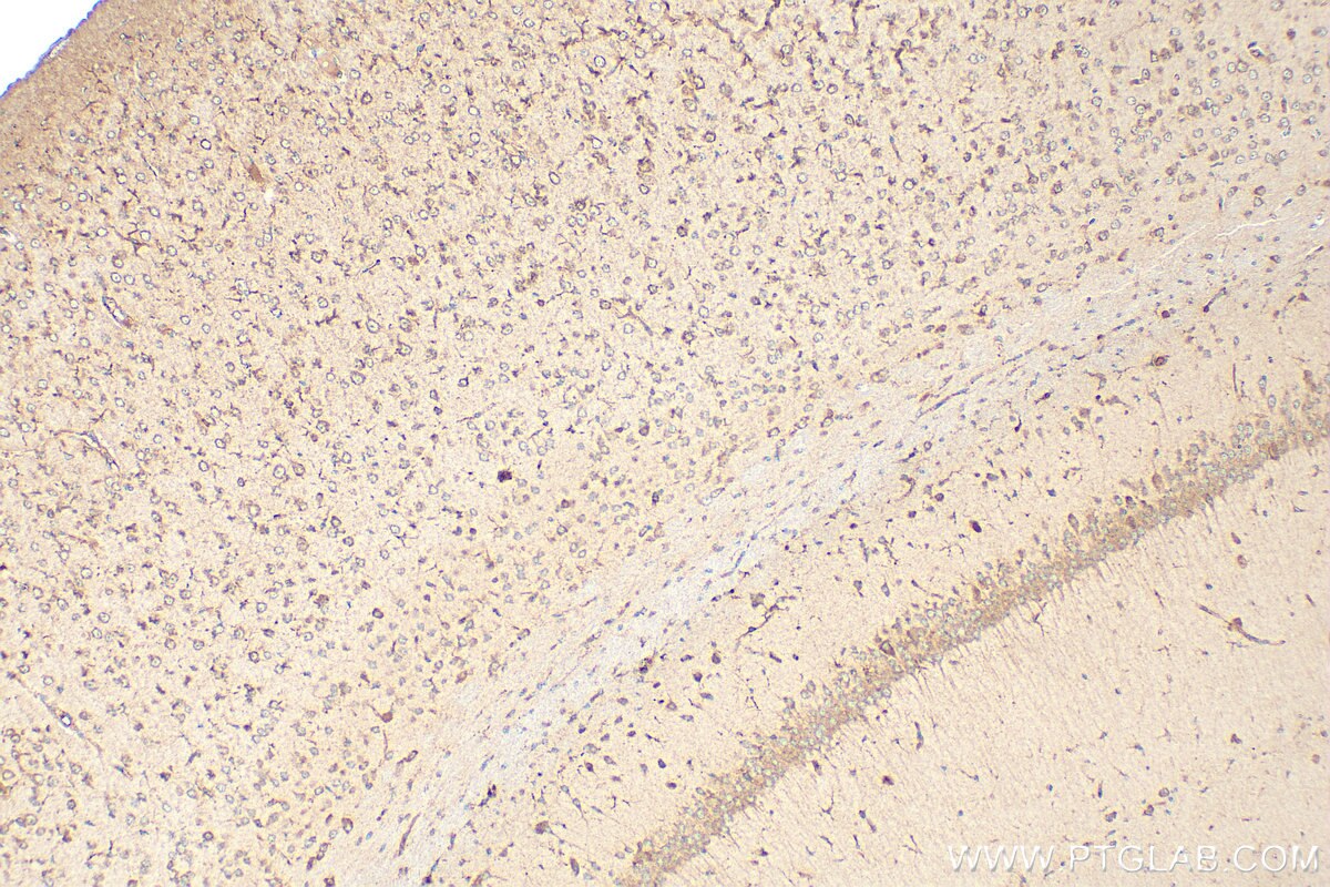 Immunohistochemistry (IHC) staining of mouse brain tissue using ROBO3-Specific Polyclonal antibody (20220-1-AP)