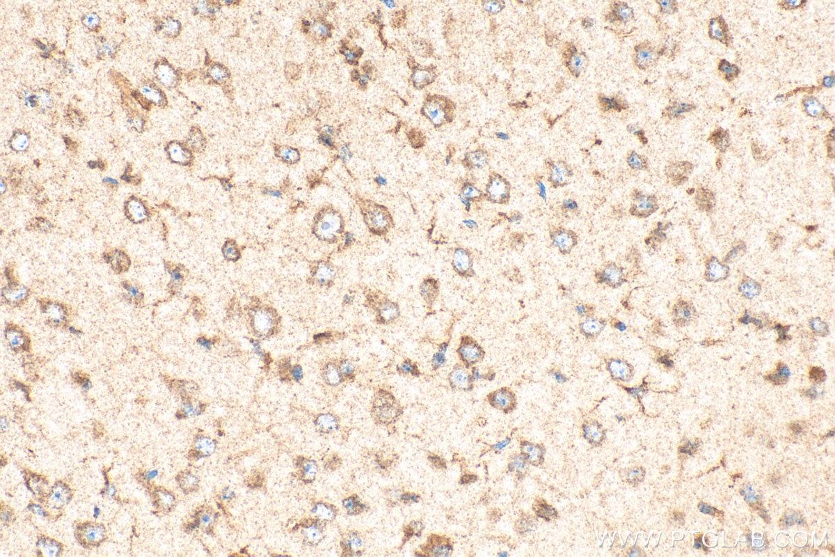 Immunohistochemistry (IHC) staining of mouse brain tissue using ROBO3-Specific Polyclonal antibody (20220-1-AP)