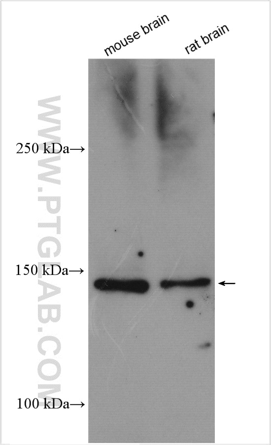 Western Blot (WB) analysis of various lysates using ROBO3-Specific Polyclonal antibody (20220-1-AP)