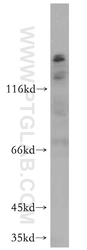 Western Blot (WB) analysis of HepG2 cells using ROBO4-Specific Polyclonal antibody (20221-1-AP)