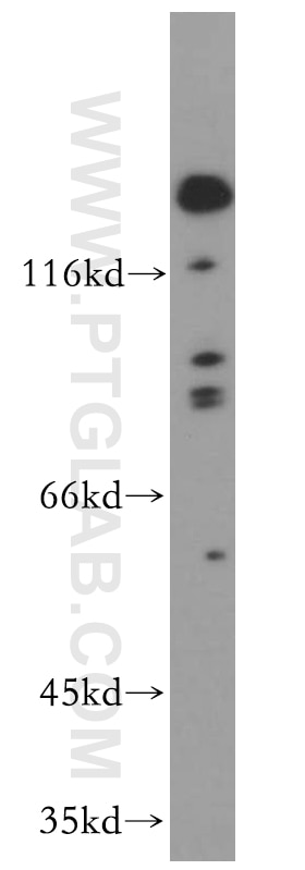 Western Blot (WB) analysis of HeLa cells using ROBO4-Specific Polyclonal antibody (20221-1-AP)