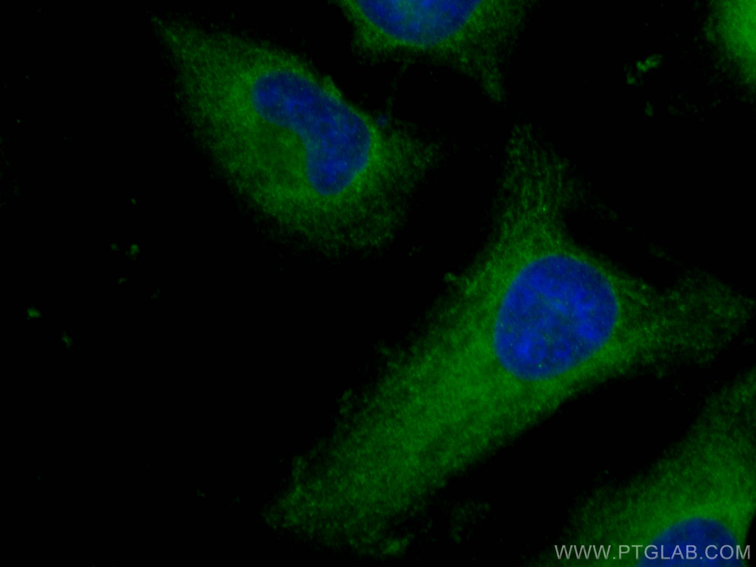 Immunofluorescence (IF) / fluorescent staining of HeLa cells using ROCK1 Polyclonal antibody (21850-1-AP)