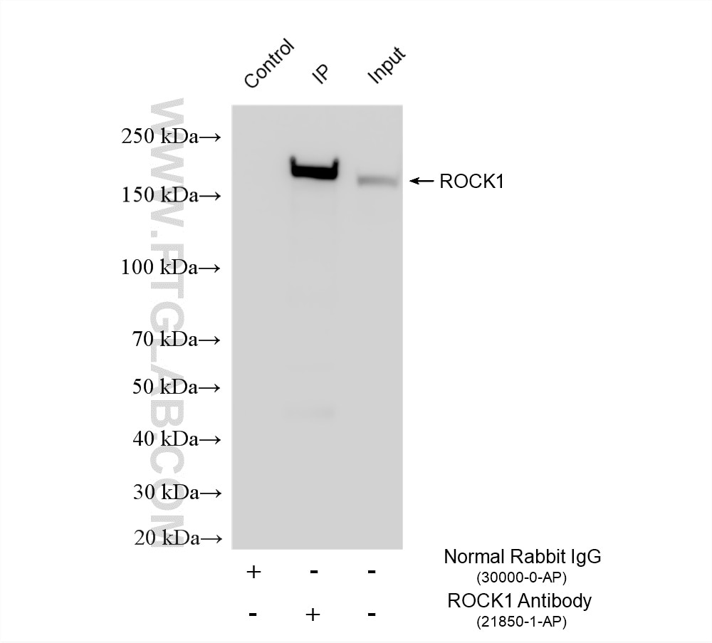 Immunoprecipitation (IP) experiment of C6 cells using ROCK1 Polyclonal antibody (21850-1-AP)