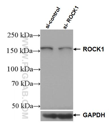 Western Blot (WB) analysis of HeLa cells using ROCK1 Polyclonal antibody (21850-1-AP)