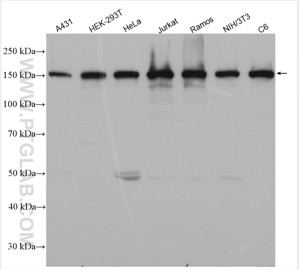 Western Blot (WB) analysis of various lysates using ROCK1 Polyclonal antibody (21850-1-AP)