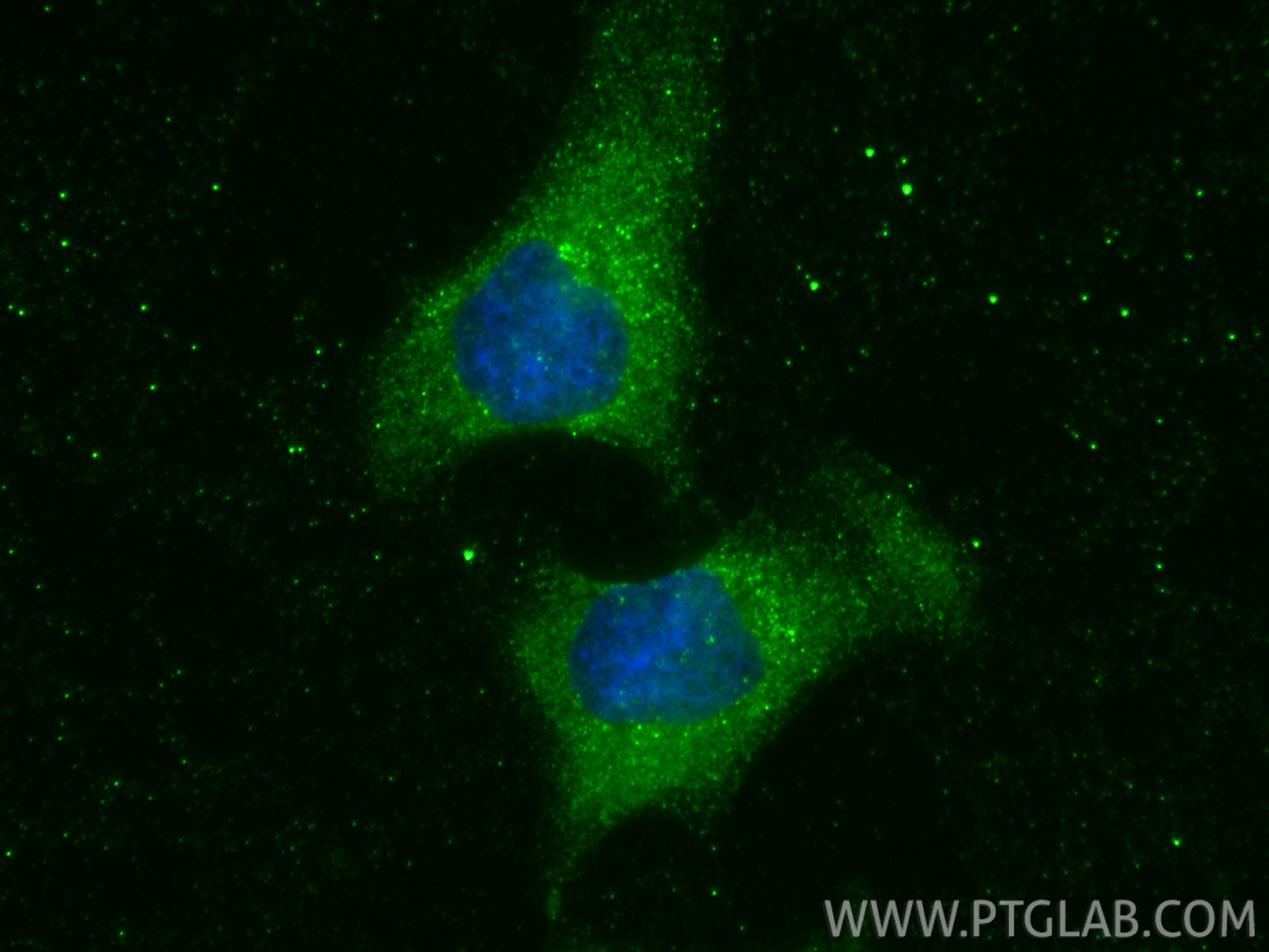 IF Staining of HeLa using 66782-1-Ig Immunofluorescence (IF) / fluorescent staining of HeLa cells using ROCK1 Monoclonal antibody (66782-1-Ig)