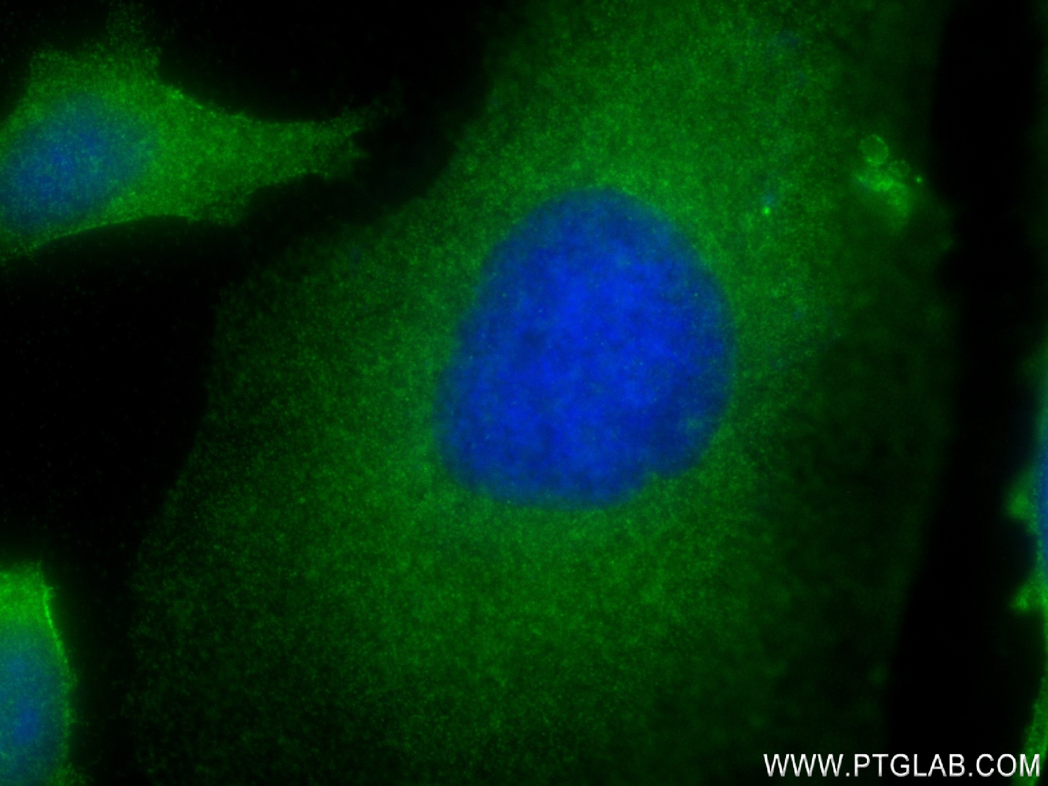 Immunofluorescence (IF) / fluorescent staining of HeLa cells using ROCK1 Recombinant antibody (83166-5-RR)