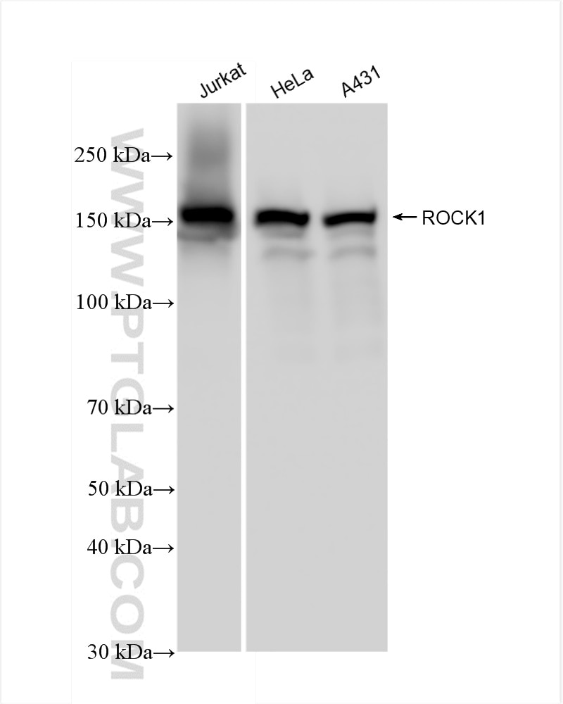 Western Blot (WB) analysis of various lysates using ROCK1 Recombinant antibody (83166-5-RR)