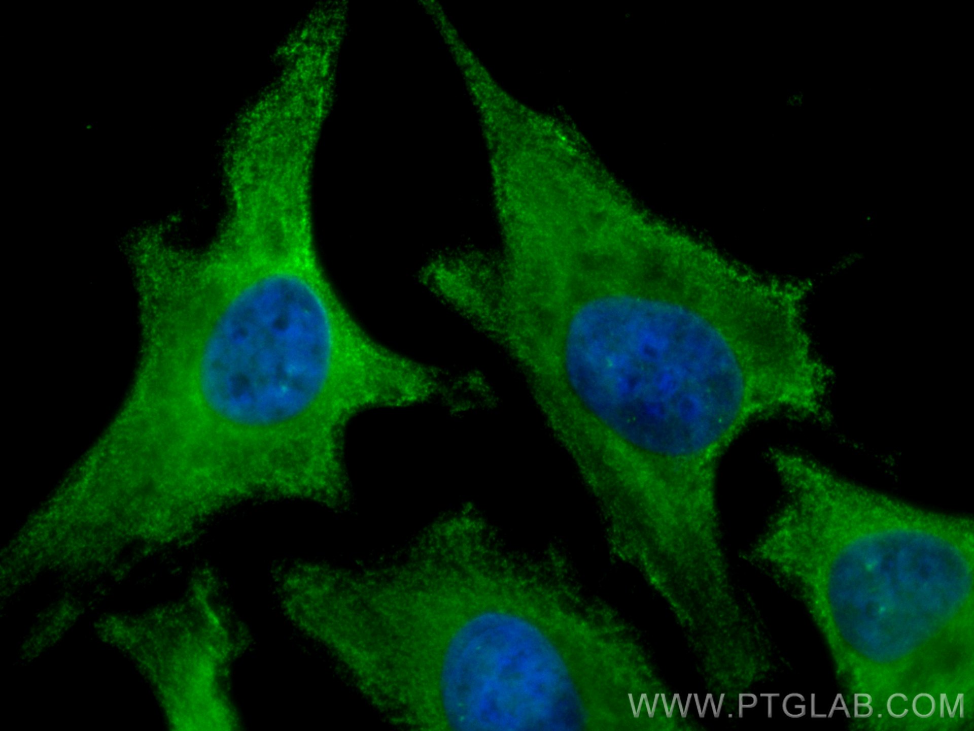 Immunofluorescence (IF) / fluorescent staining of HeLa cells using CoraLite® Plus 488-conjugated ROCK1 Polyclonal ant (CL488-21850)