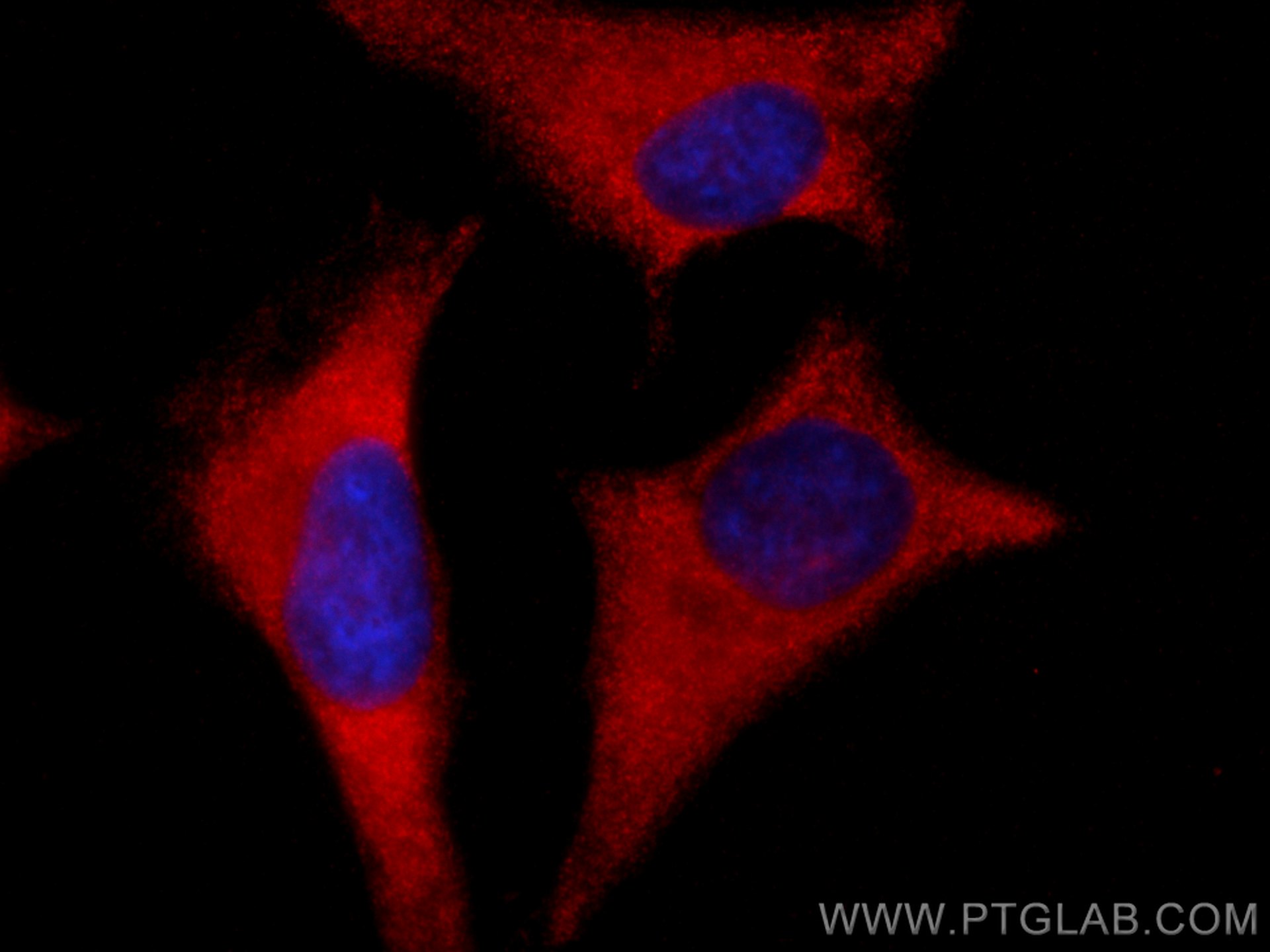 Immunofluorescence (IF) / fluorescent staining of HeLa cells using CoraLite®594-conjugated ROCK1 Polyclonal antibody (CL594-21850)