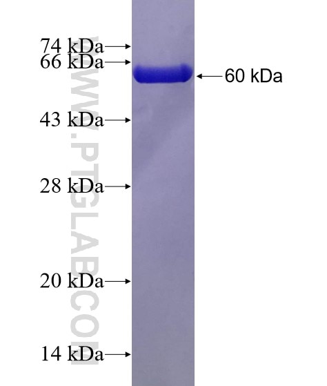 ROCK1 fusion protein Ag16317 SDS-PAGE