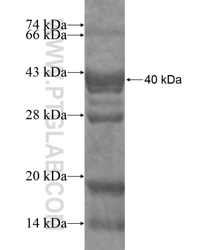 ROCK1 fusion protein Ag17393 SDS-PAGE