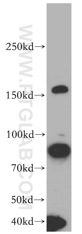 Western Blot (WB) analysis of HeLa cells using ROCK1-Specific Polyclonal antibody (20247-1-AP)