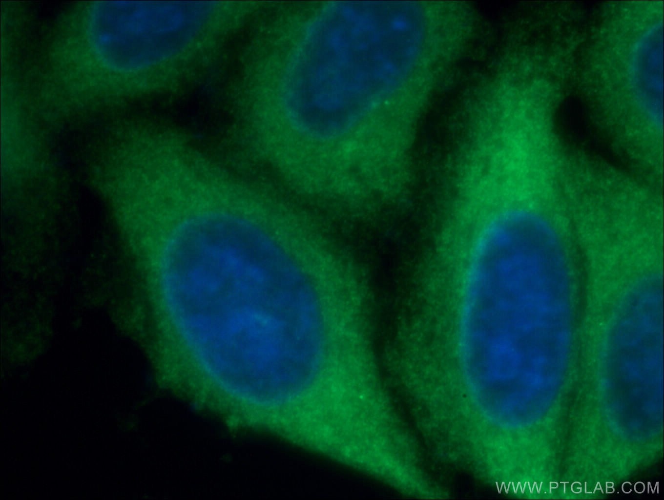Immunofluorescence (IF) / fluorescent staining of HepG2 cells using ROCK2(middle) Polyclonal antibody (21645-1-AP)