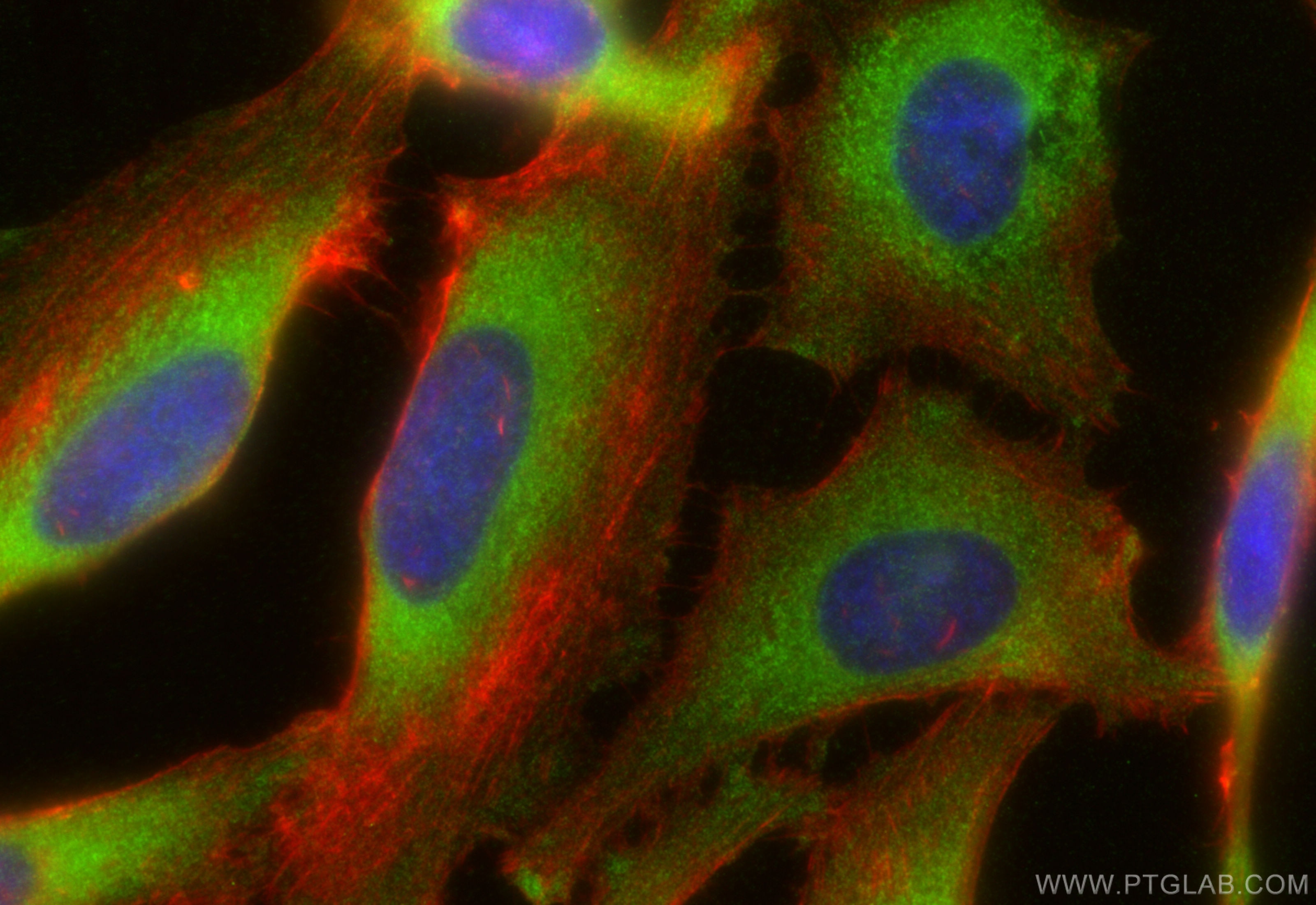 Immunofluorescence (IF) / fluorescent staining of HeLa cells using ROCK2(middle) Polyclonal antibody (21645-1-AP)