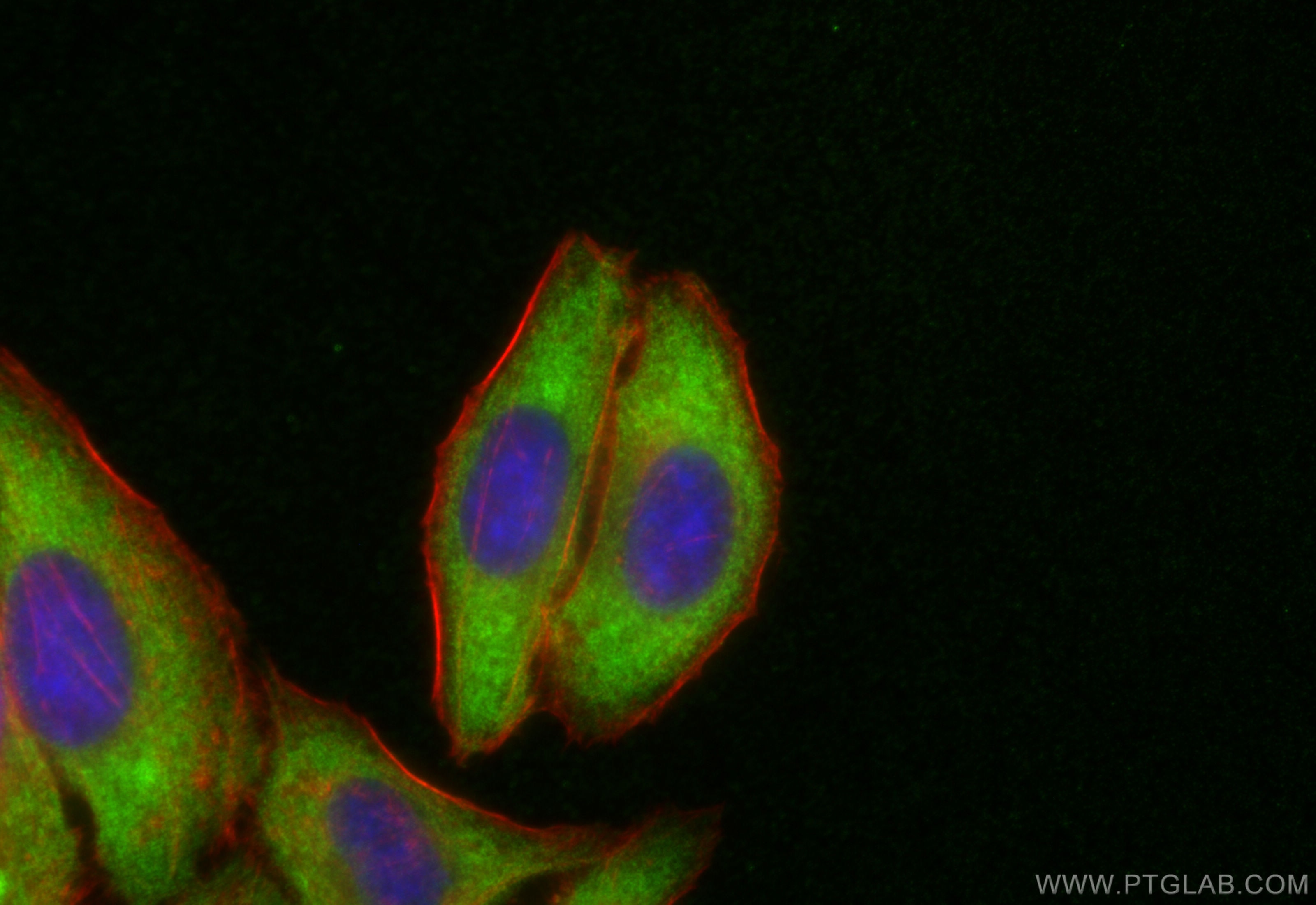 Immunofluorescence (IF) / fluorescent staining of HepG2 cells using ROCK2(middle) Polyclonal antibody (21645-1-AP)
