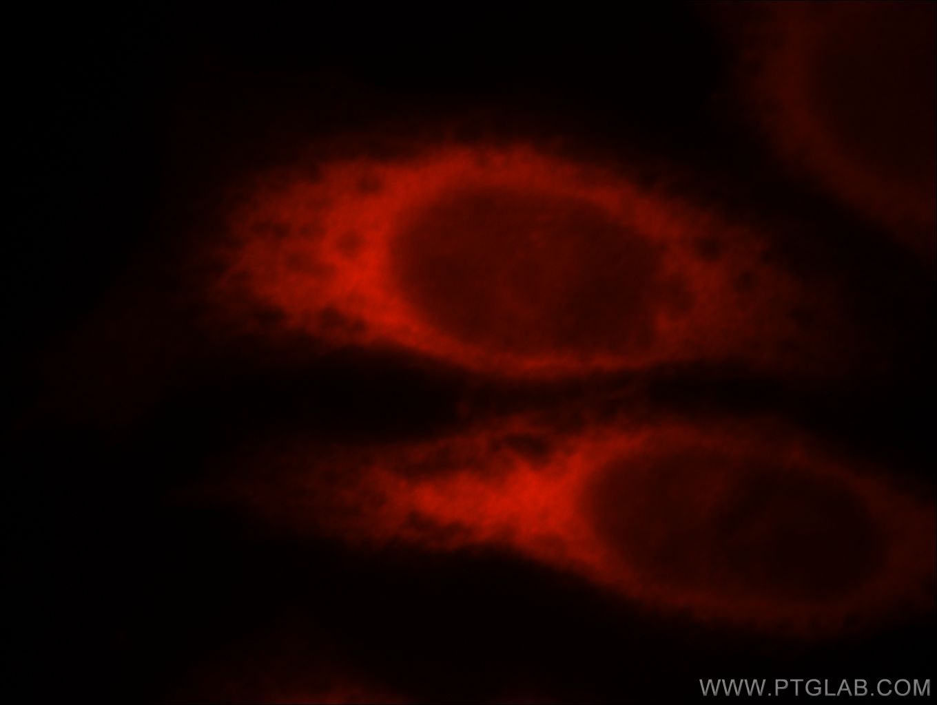 Immunofluorescence (IF) / fluorescent staining of HeLa cells using ROCK2(middle) Polyclonal antibody (21645-1-AP)
