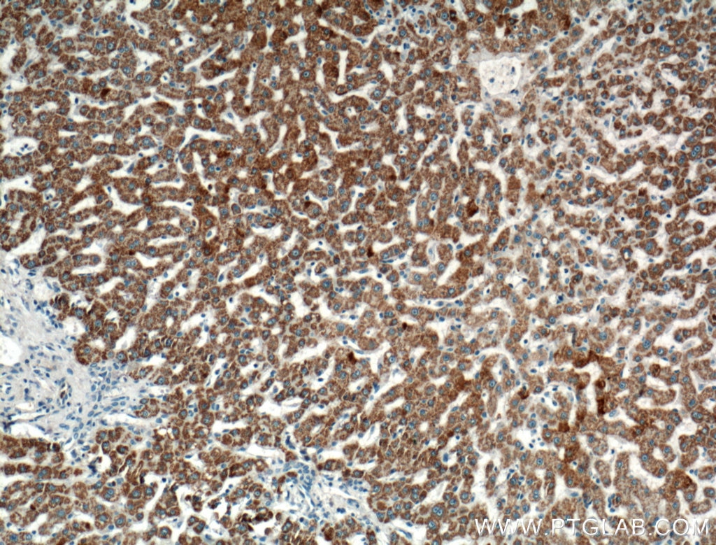 Immunohistochemistry (IHC) staining of human liver tissue using ROCK2(middle) Polyclonal antibody (21645-1-AP)