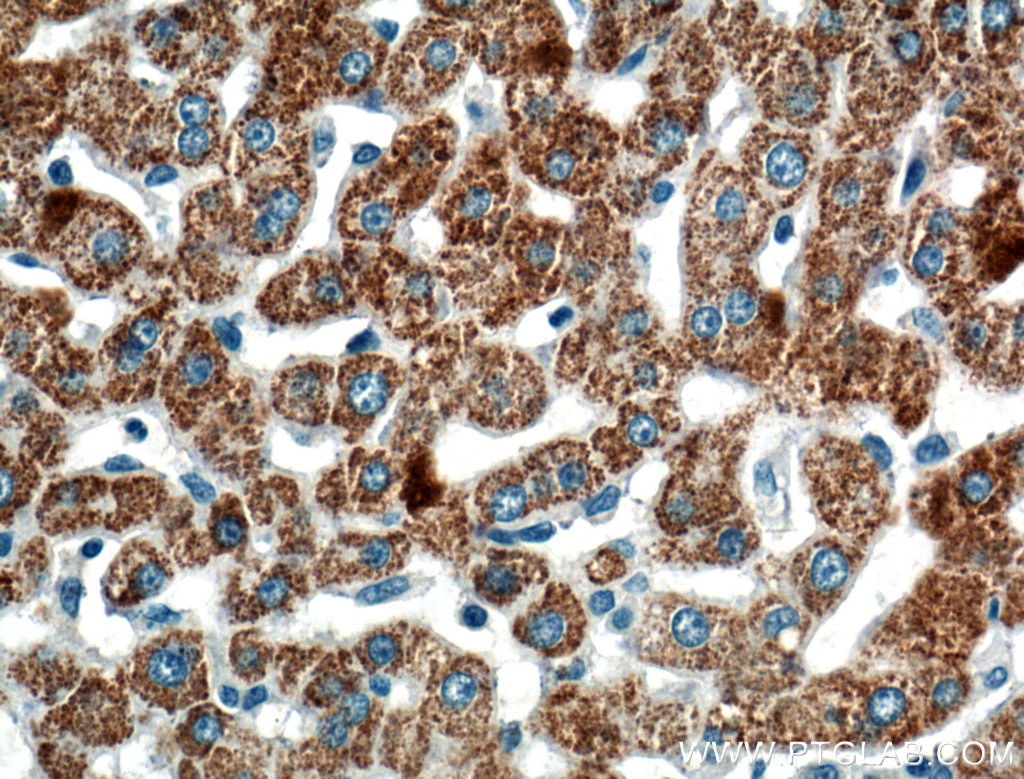 Immunohistochemistry (IHC) staining of human liver tissue using ROCK2(middle) Polyclonal antibody (21645-1-AP)
