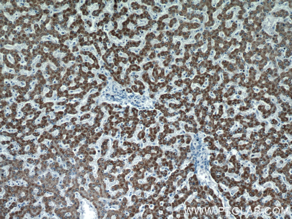 IHC staining of human liver using 21645-1-AP