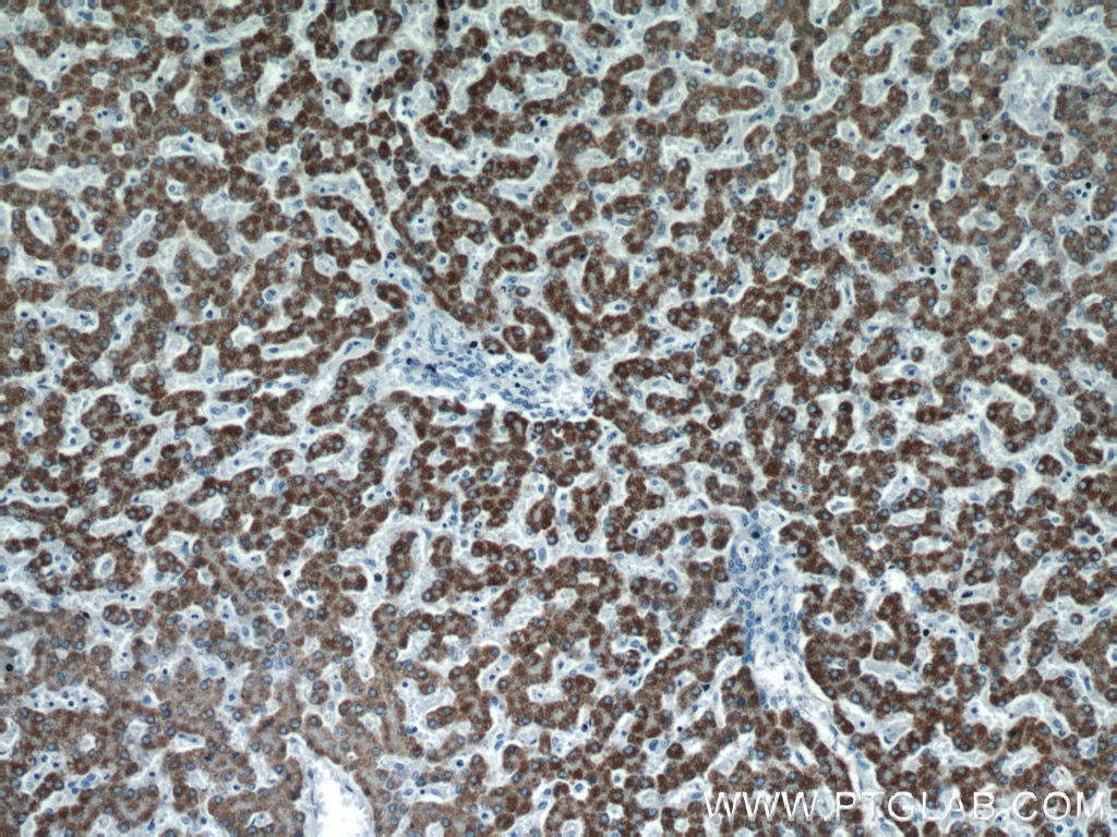 Immunohistochemistry (IHC) staining of human liver tissue using ROCK2(middle) Polyclonal antibody (21645-1-AP)