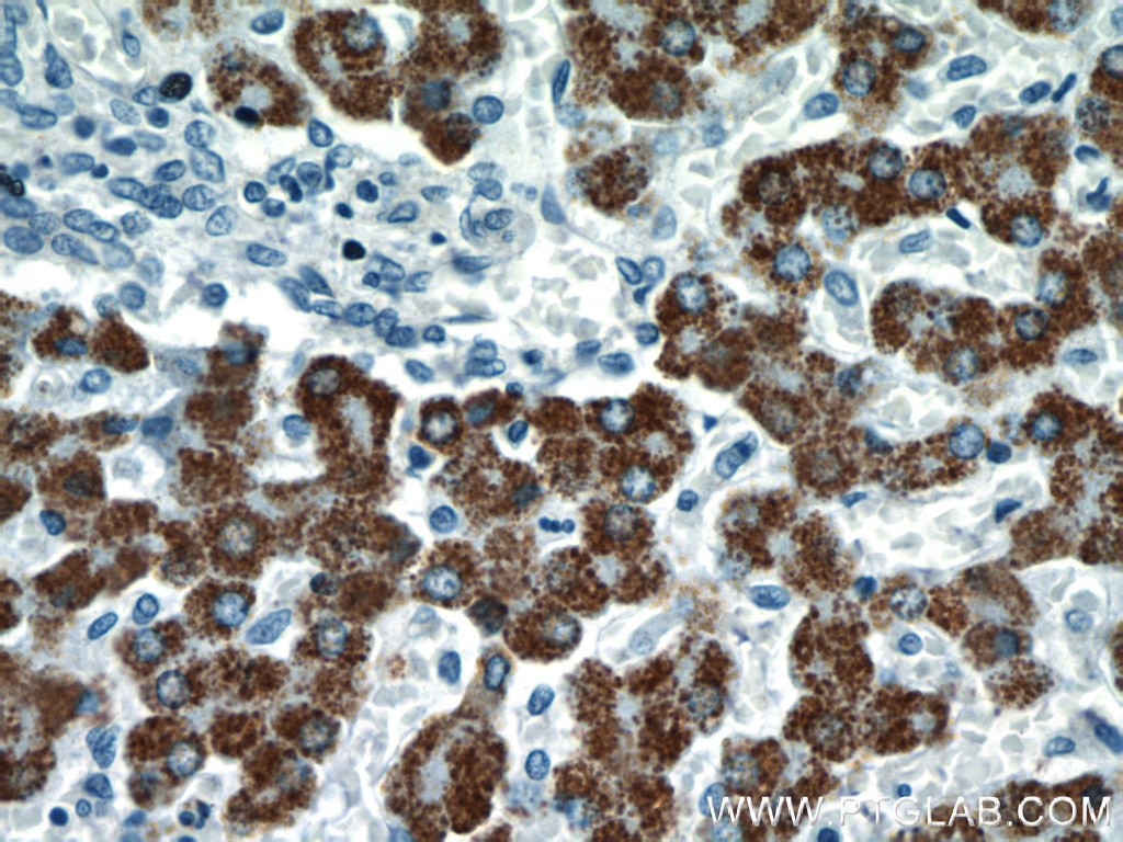 Immunohistochemistry (IHC) staining of human liver tissue using ROCK2(middle) Polyclonal antibody (21645-1-AP)