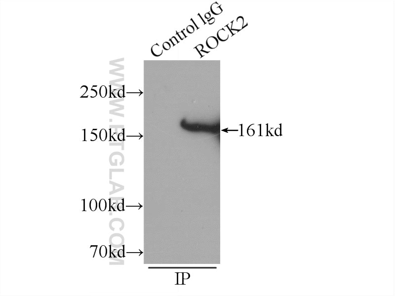 Immunoprecipitation (IP) experiment of HeLa cells using ROCK2(middle) Polyclonal antibody (21645-1-AP)