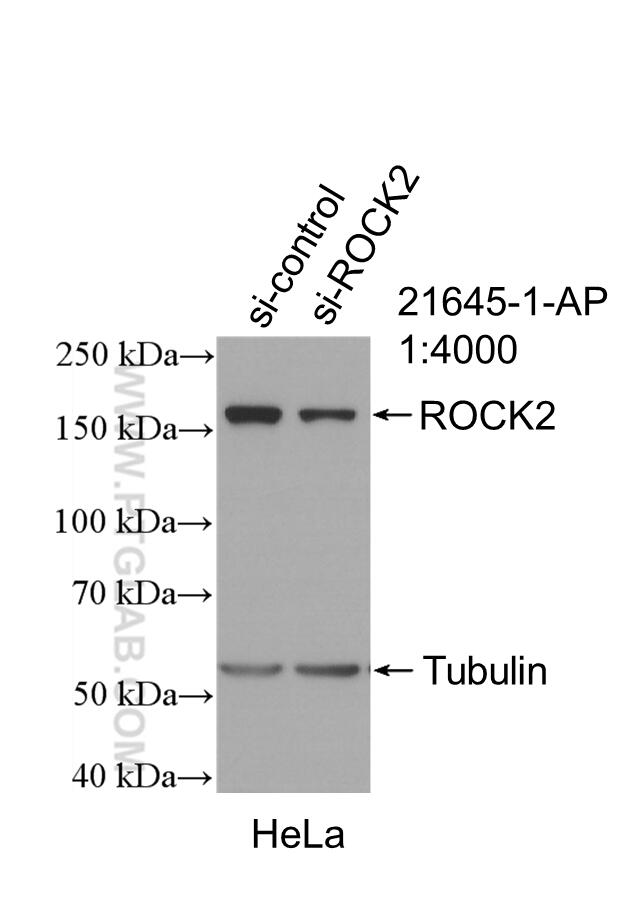 Western Blot (WB) analysis of HeLa cells using ROCK2(middle) Polyclonal antibody (21645-1-AP)