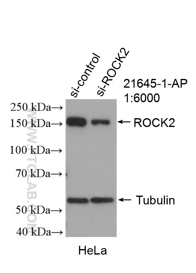 Western Blot (WB) analysis of HeLa cells using ROCK2(middle) Polyclonal antibody (21645-1-AP)