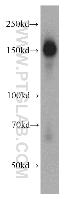 Western Blot (WB) analysis of mouse brain tissue using ROCK2(middle) Polyclonal antibody (21645-1-AP)