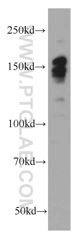 Western Blot (WB) analysis of mouse lung tissue using ROCK2(middle) Polyclonal antibody (21645-1-AP)