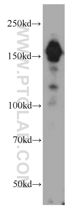 Western Blot (WB) analysis of MCF-7 cells using ROCK2(middle) Polyclonal antibody (21645-1-AP)