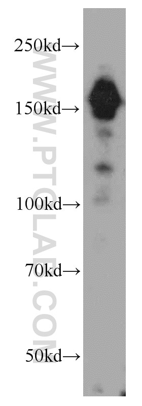 WB analysis of MCF-7 using 21645-1-AP