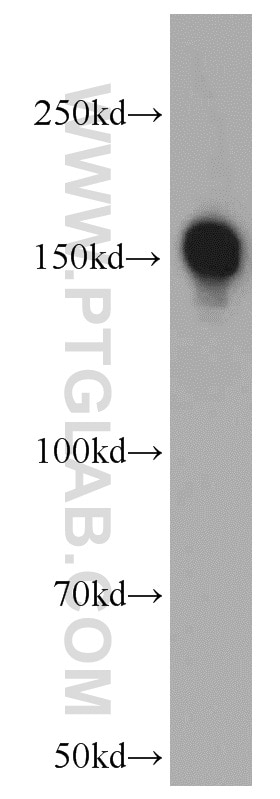 Western Blot (WB) analysis of mouse liver tissue using ROCK2(middle) Polyclonal antibody (21645-1-AP)