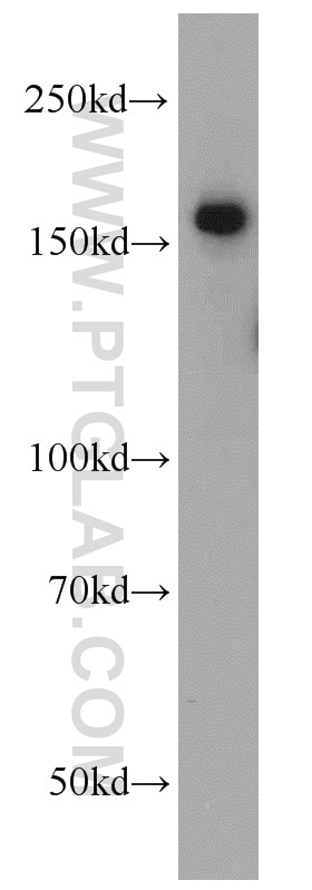 Western Blot (WB) analysis of HeLa cells using ROCK2(middle) Polyclonal antibody (21645-1-AP)