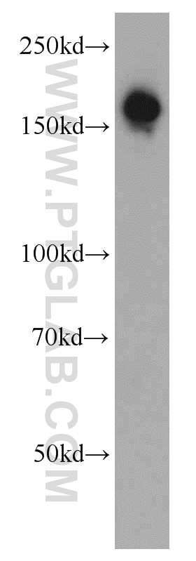 Western Blot (WB) analysis of L02 cells using ROCK2(middle) Polyclonal antibody (21645-1-AP)